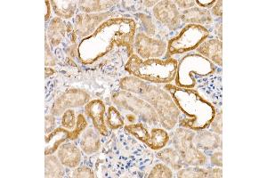 Immunohistochemistry (IHC) image for anti-ATG7 Autophagy Related 7 (ATG7) (AA 500-676) antibody (ABIN3021091)