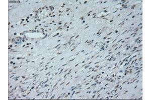 Immunohistochemical staining of paraffin-embedded Kidney tissue using anti-NEUROG1mouse monoclonal antibody. (Neurogenin 1 Antikörper)