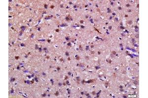 Formalin-fixed and paraffin embedded rat brain labeled with Anti-Syndetin Polyclonal Antibody, Unconjugated  at 1:200 followed by conjugation to the secondary antibody and DAB staining. (Syndetin (VPS50) (AA 3-100) Antikörper)