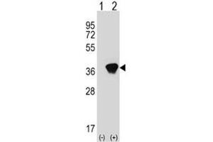 Western Blotting (WB) image for anti-Aldo-Keto Reductase Family 1, Member A1 (Aldehyde Reductase) (AKR1A1) (AA 293-325) antibody (ABIN3029900)
