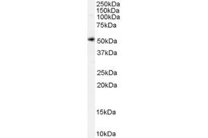 Image no. 2 for anti-Solute Carrier Family 7, (Cationic Amino Acid Transporter, Y+ System) Member 11 (SLC7A11) (Internal Region) antibody (ABIN190899)