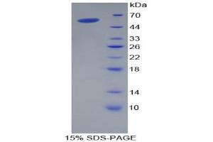 SDS-PAGE (SDS) image for CD8a Molecule (CD8A) (AA 27-247) protein (His tag,GST tag) (ABIN1879577)