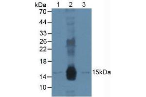 Figure. (DDB2 Antikörper  (AA 166-383))