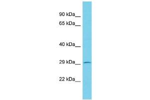 Host: Rabbit Target Name: KCTD2 Sample Type: RPMI-8226 Whole Cell lysates Antibody Dilution: 1. (KCTD2 Antikörper  (C-Term))