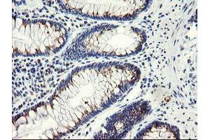 Immunohistochemical staining of paraffin-embedded Human colon tissue using anti-ACBD3 mouse monoclonal antibody. (ACBD3 Antikörper)