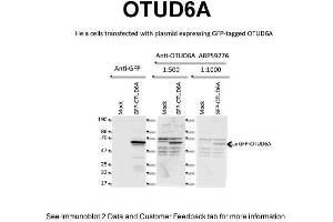 WB Suggested Anti-OTUD6A Antibody Titration: 2 ug/mlPositive Control: Human HeLa Cell line