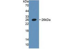 Western blot analysis of recombinant Human PDPN. (Podoplanin Antikörper  (AA 23-143))