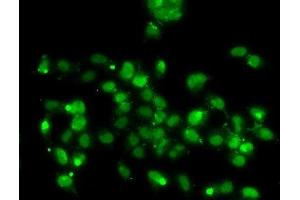 Immunofluorescence analysis of A-549 cells using WBSCR22 Polyclonal Antibody (WBSCR22 Antikörper)