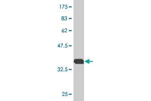 Western Blot detection against Immunogen (36. (RAB7B Antikörper  (AA 100-199))