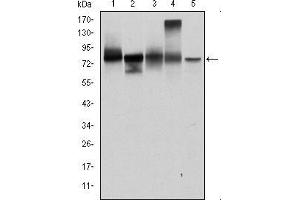 Western blot analysis using JUP mouse mAb against T47D (1), MCF-7 (2), SKBR-3 (3), A431 (4) and HEK293 (5) cell lysate.