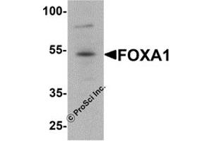 Western Blotting (WB) image for anti-Forkhead Box A1 (FOXA1) antibody (ABIN1077450) (FOXA1 Antikörper)