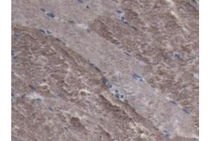 Immunohistochemistry (IHC) image for anti-Lactate Dehydrogenase A (LDHA) (AA 1-332) antibody (ABIN7443497)