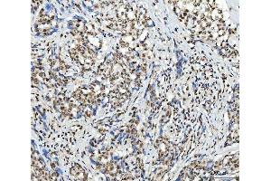 IHC analysis of SCML1 using anti-SCML1 antibody (ABIN7602479).