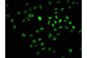 Immunofluorescence (IF) image for anti-B-Cell CLL/lymphoma 9 (BCL9) (AA 231-340) antibody (ABIN7145150)