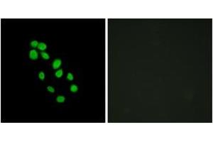 Immunofluorescence analysis of HepG2 cells, using IRX2 Antibody. (IRX2 Antikörper  (AA 231-280))