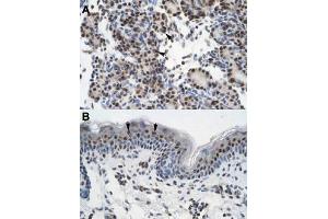 Immunohistochemical staining (Formalin-fixed paraffin-embedded sections) of human pancreas (A) and human skin (B) with GTF2I polyclonal antibody  at 4-8 ug/mL working concentration. (GTF2I Antikörper  (N-Term))