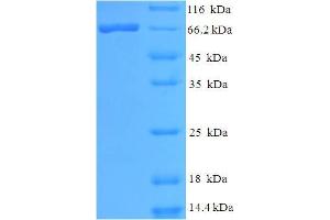 SDS-PAGE (SDS) image for VL2 (AA 1-462), (full length) protein (His-SUMO Tag) (ABIN5711008) (VL2 (AA 1-462), (full length) protein (His-SUMO Tag))