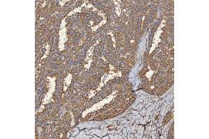 IHC analysis of SEC31A using anti-SEC31A antibody (ABIN7599630).