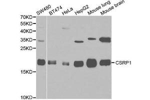 Western blot analysis of various cell lines, using CSRP1 antibody. (CSRP1 Antikörper)