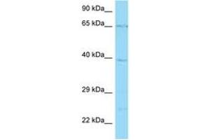 Image no. 1 for anti-Solute Carrier Family 22 Member 5 (SLC22A5) (AA 305-354) antibody (ABIN6748406) (SLC22A5 Antikörper  (AA 305-354))