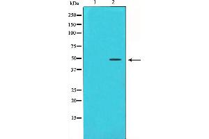 Western blot analysis on HeLa cell lysate using Cyclin E1 Antibody,The lane on the left is treated with the antigen-specific peptide. (Cyclin E1 Antikörper  (C-Term))