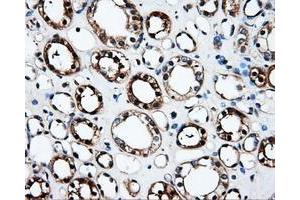 Immunohistochemical staining of paraffin-embedded Kidney tissue using anti-FAHD2Amouse monoclonal antibody. (FAHD2A Antikörper)
