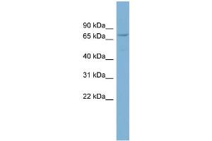 WB Suggested Anti-CNOT4 Antibody Titration: 0. (CNOT4 Antikörper  (Middle Region))