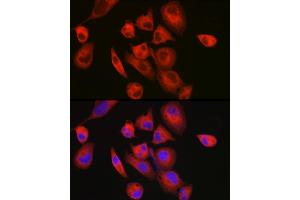 Immunofluorescence analysis of RD cells using MYH7/β-MHC Rabbit pAb (ABIN6129609, ABIN6144239, ABIN6144240 and ABIN6223471) at dilution of 1:150 (40x lens). (MYH7 Antikörper  (AA 1766-1935))