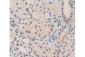 Used in DAB staining on fromalin fixed paraffin- embedded Kidney tissue (NUP133 Antikörper  (AA 899-1091))