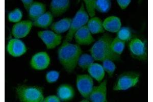 IF analysis of SRI using anti-SRI antibody (ABIN7599836). (SRI Antikörper  (AA 121-161))