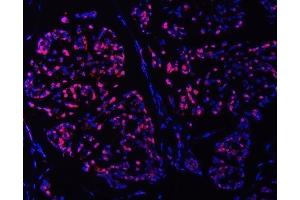IF analysis of SMC6 using anti-SMC6 antibody (ABIN7601864). (SMC6 Antikörper  (AA 499-1018))