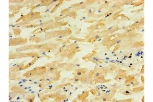 Immunohistochemistry of paraffin-embedded human heart tissue using ABIN7150611 at dilution of 1:100