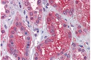 Human Kidney: Formalin-Fixed, Paraffin-Embedded (FFPE)