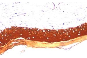 Formalin-fixed, paraffin-embedded human Skin stained with Cytokeratin, LMW Monoclonal Antibody (KRTL/1077).