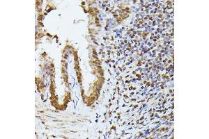 Immunohistochemistry of paraffin-embedded rat lung using HNRNPL antibody (ABIN6128048, ABIN6141915, ABIN6141917 and ABIN6216076) at dilution of 1:100 (40x lens). (HNRNPL Antikörper  (AA 282-589))