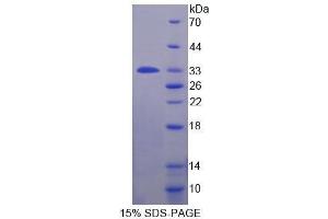 SDS-PAGE (SDS) image for phospholipase A2 Receptor 1, 180kDa (PLA2R1) (AA 385-643) protein (His tag) (ABIN1878947)