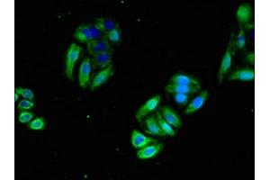 Immunofluorescent analysis of HepG2 cells using ABIN7154637 at dilution of 1:100 and Alexa Fluor 488-congugated AffiniPure Goat Anti-Rabbit IgG(H+L) (GTPase NRas Antikörper  (AA 1-186))