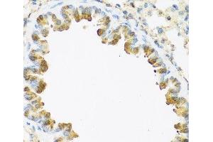 Immunohistochemistry of paraffin-embedded Mouse lung using S100A7 Polyclonal Antibody at dilution of 1:100 (40x lens). (S100A7 Antikörper)
