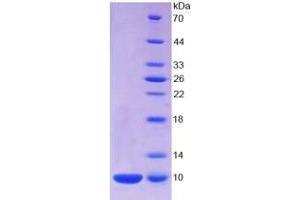 SDS-PAGE analysis of Human S100A7 Protein. (S100A7 Protein)