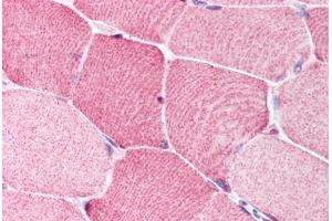 Human Skeletal Muscle (formalin-fixed, paraffin-embedded) stained with BRCC3 antibody ABIN213911 at 5 ug/ml followed by biotinylated goat anti-rabbit IgG secondary antibody ABIN481713, alkaline phosphatase-streptavidin and chromogen. (BRCC3 Antikörper  (N-Term))