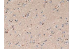 IHC-P analysis of Human Brain Tissue, with DAB staining. (Coronin 1a Antikörper  (AA 7-204))