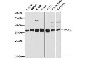 Western blot analysis of extracts of various cell lines using EXOSC7 Polyclonal Antibody at dilution of 1:3000. (EXOSC7 Antikörper)