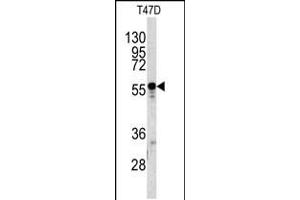 Western blot analysis of A1BG antibody in T47D cell line lysates (35ug/lane) (A1BG Antikörper  (C-Term))