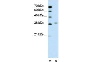 Western Blotting (WB) image for anti-Aminolevulinate Dehydratase (ALAD) antibody (ABIN2462445) (ALAD Antikörper)