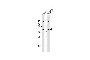 All lanes : Anti-ACTR2 Antibody (C-term) at 1:1000 dilution Lane 1: Hela whole cell lysate Lane 2: MCF-7 whole cell lysate Lysates/proteins at 20 μg per lane.