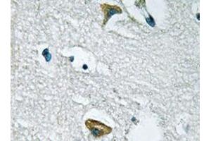 Immunohistochemistry analyzes of JAK3 antibody in paraffin-embedded human brain tissue. (JAK3 Antikörper)