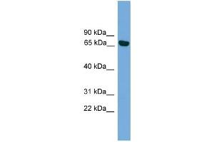 WB Suggested Anti-PRKCI Antibody Titration: 0. (PKC iota Antikörper  (Middle Region))