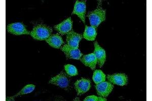 IF analysis of EGFR using anti-EGFR antibody (ABIN7599622). (EGFR Antikörper  (AA 1006-1210))