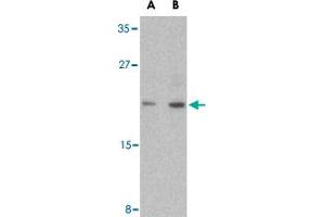 Western blot analysis of CASP6 in MCF-7 cell lysate with CASP6 polyclonal antibody  at (A) 1 and (B) 2 ug/mL .