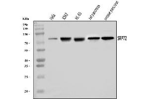 Western blot analysis of SRP72 using anti-SRP72 antibody (ABIN7601648). (SRP72 Antikörper  (AA 40-460))